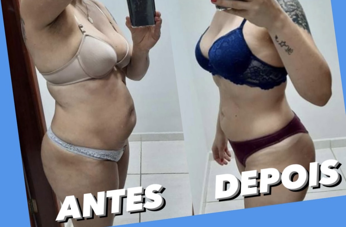 Resultado Aluna - Perfil Abdominal